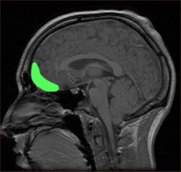 Exploring the Fascinating Link Between Orgasms and Cognitive Function